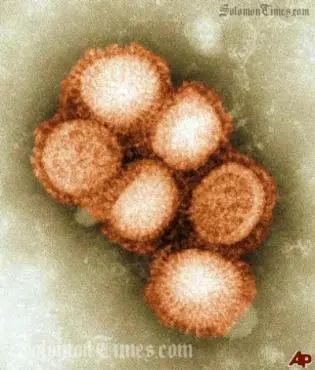 According to the WHO, there have been at least 29,669 cases of the swine (H1N1) flu, including 145 deaths.