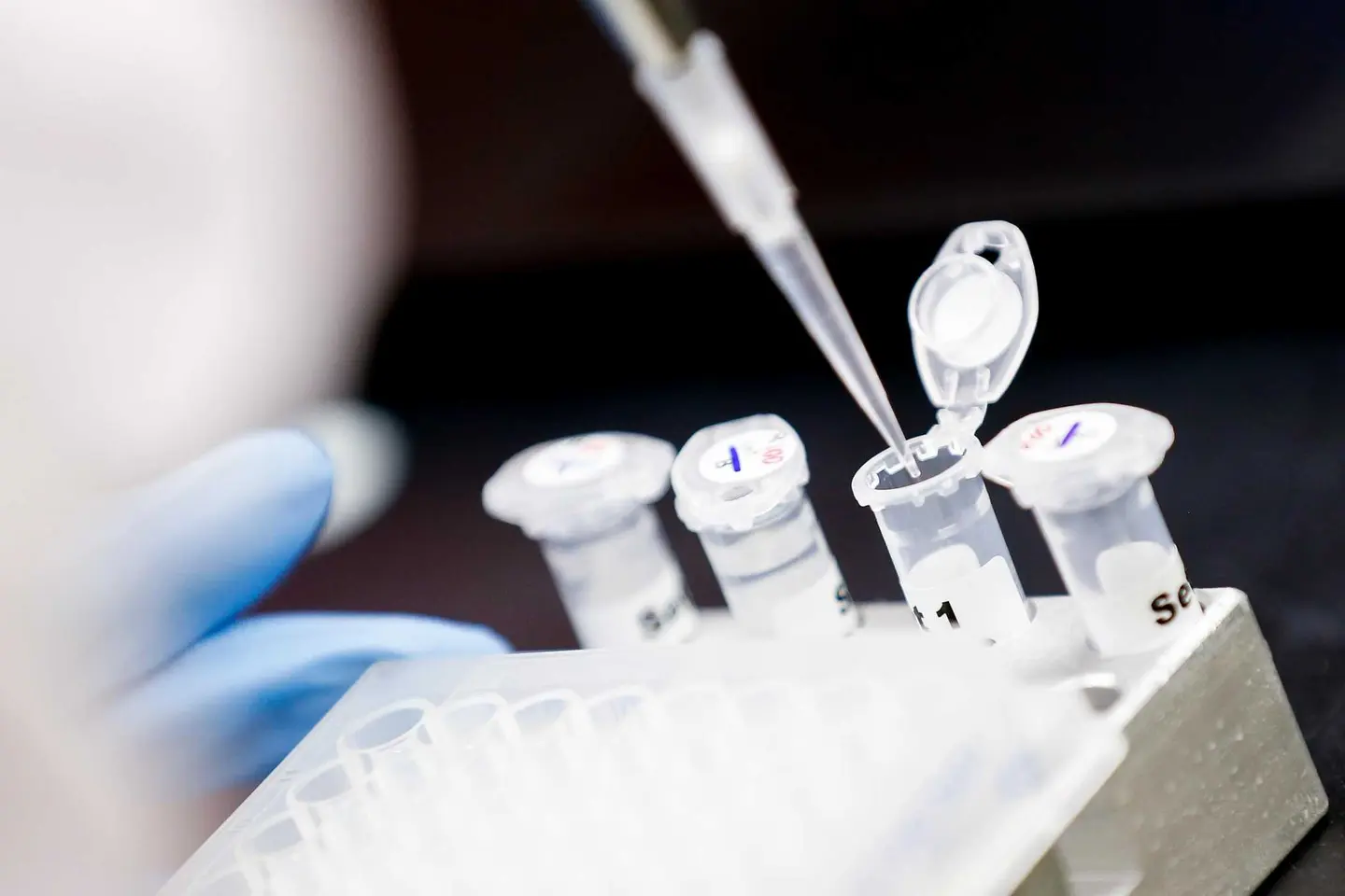 “There is evidence that the Omicron BA 2 variant was in circulation on April 6 and is now the primary driver of the COVID-19 situation in Honiara,” the Health Minister says.