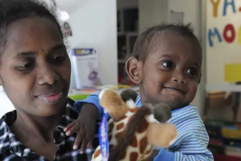 Charlie Rao, 22 months, from the Solomon Islands, with his mother Mary Ribe, before his life-changing surgery at The Canberra Hospital.