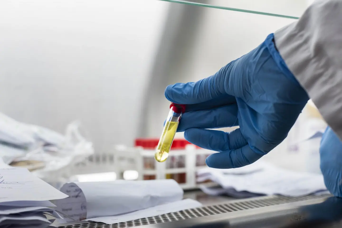 “The Ministry of Health and Medical Services will be submitting the COVAX application to the Global Alliance for Vaccines and Immunization [GAVI] on 5 December 2020”, Sogavare says.