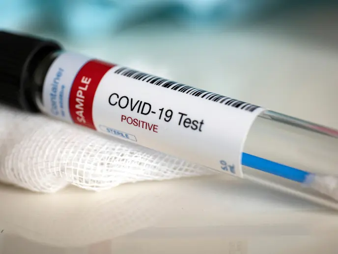 He says the latest development means the total cases of positive COVID-19 recorded in the Solomon Islands is now 18.