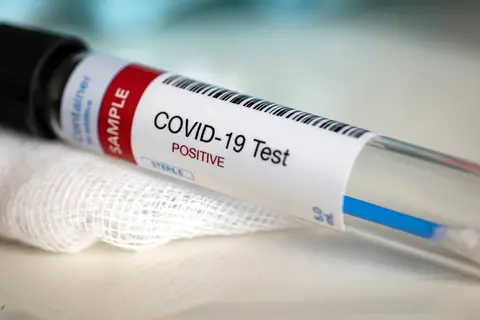 He says the latest development means the total cases of positive COVID-19 recorded in the Solomon Islands is now 18.