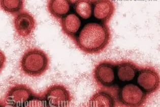The latest swine flu case is being quarantined at RAMSI's Aspen Medical Centre.