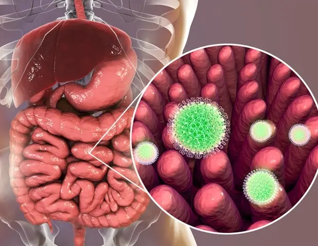 Rotavirus is the most common cause of diarrhea disease among infants and young children.