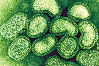 In the Solomon Islands, flu cases are being treated as a medical priority effective as of this morning.