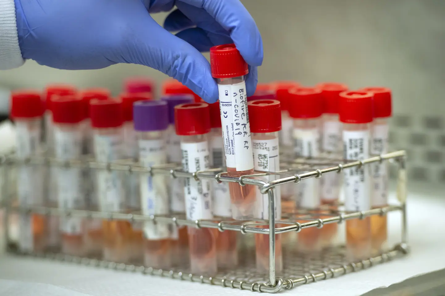 He adds, a total of 28,000 tests have been conducted since the beginning of the country’s response to the global pandemic.