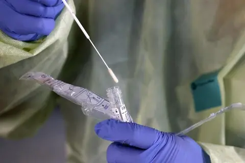 They say if patients are not showing signs and symptoms of being sick, such as runny nose, coughing, fever and shortness of breath they will not be swabbed for tests.