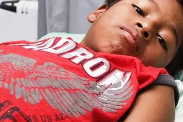 Honiara has so far recorded the highest prevalence of dengue fever with 89 per cent of reported cases.